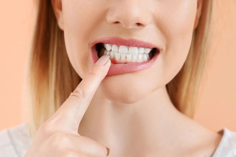 Tại sao nướu răng bị chảy máu? Điều  trị và phòng ngừa như thế nào? 2