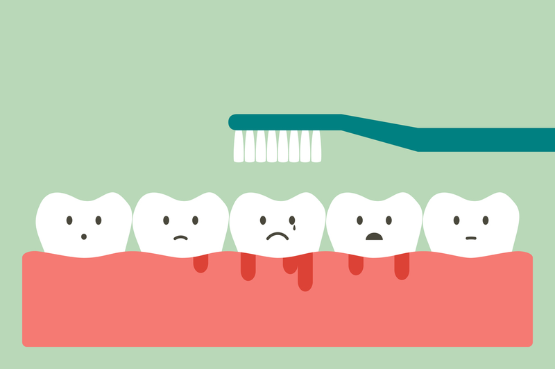 Tại sao nướu răng bị chảy máu? Điều  trị và phòng ngừa như thế nào? 3