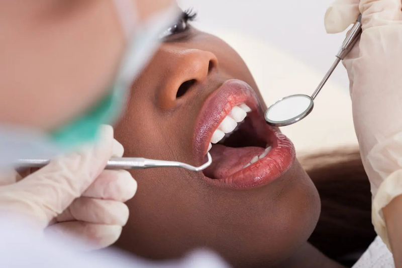 Tại sao nướu răng bị chảy máu? Điều  trị và phòng ngừa như thế nào? 5
