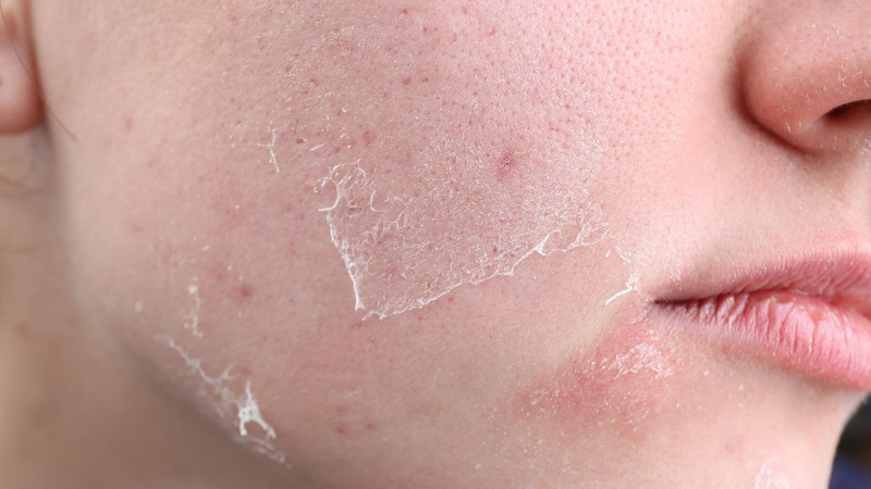 Tái tạo da bị ngứa: Nguyên nhân và cách chăm sóc ra sao? 2