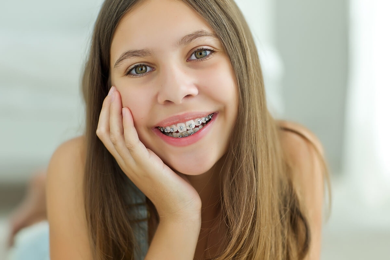 Tam giác đen khi niềng răng là gì? Nguyên nhân và cách khắc phục 4