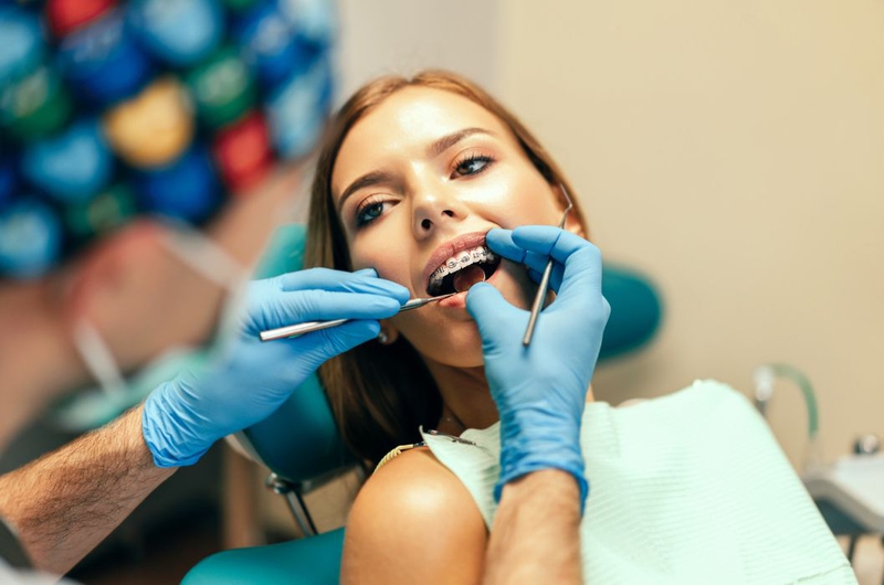 Tam giác đen khi niềng răng là gì? Nguyên nhân và cách khắc phục 3