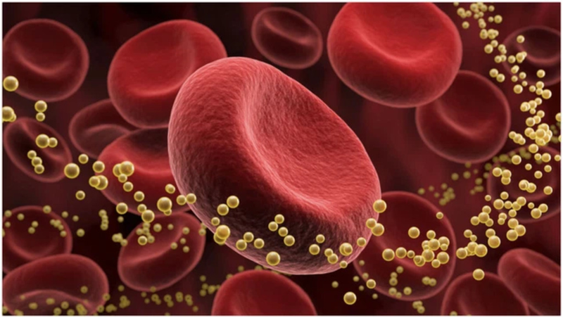 Tăng lipid máu trong hội chứng thận hư​: Nguyên nhân, triệu chứng và cách điều trị 1