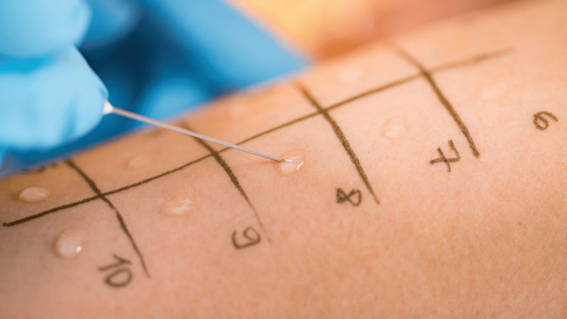 TB test là gì? Những thông tin cần biết 2