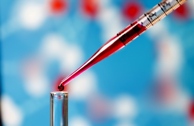 Tế bào ngoại mạch là gì? Bạn biết gì về xét nghiệm tế bào máu ngoại vi? 1