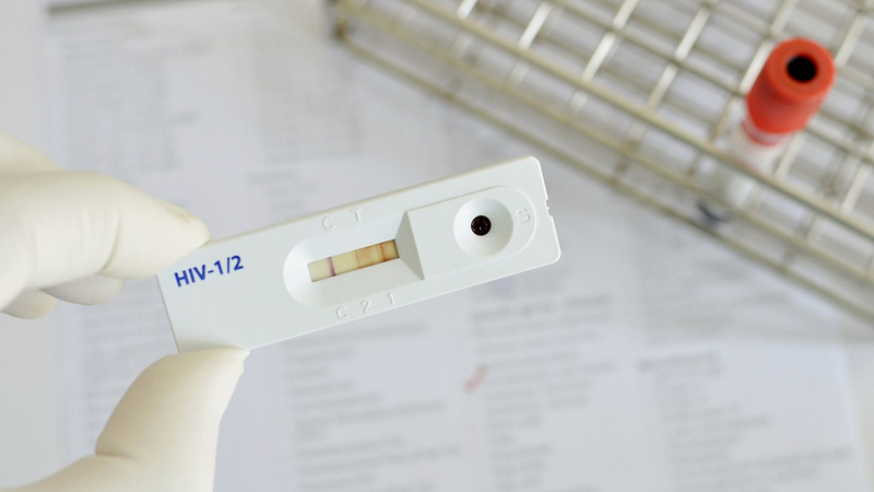 Test HIV bằng nước bọt có chính xác không? Cách thực hiện như thế nào? 2