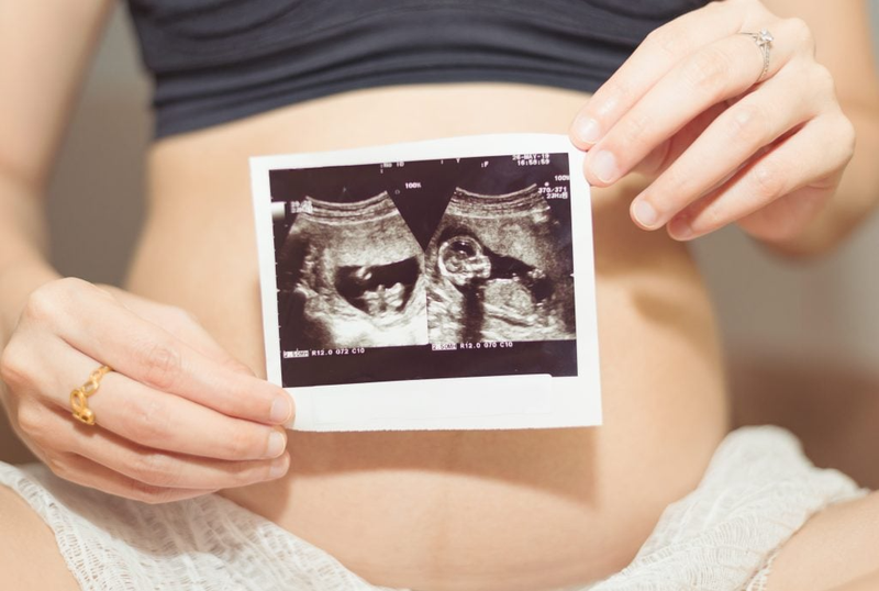 Phải làm thế nào khi thai 16 tuần gò cứng bụng? 2
