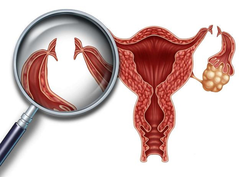 Thắt ống dẫn trứng có làm giảm ham muốn tình dục không? 1