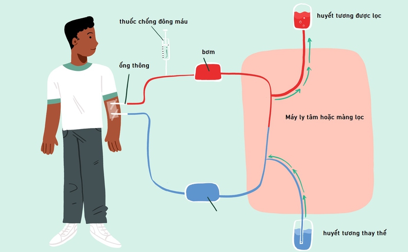 Tìm hiểu chi tiết về phương pháp thay lọc huyết tương 1