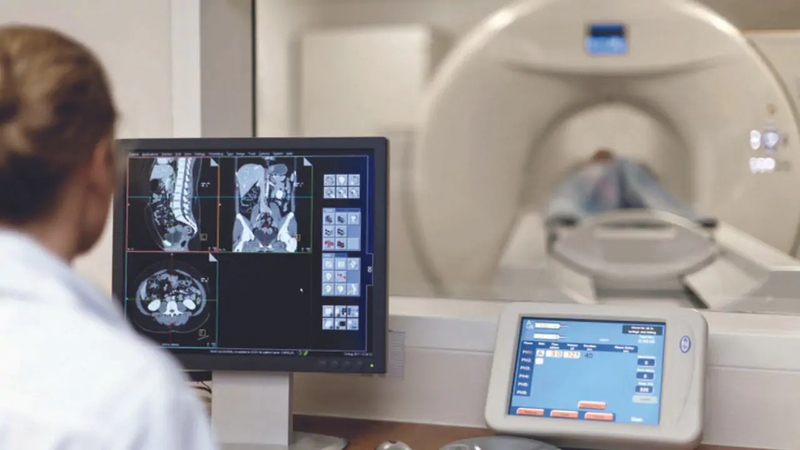 Thế nào là chụp CT phổi liều thấp? 3
