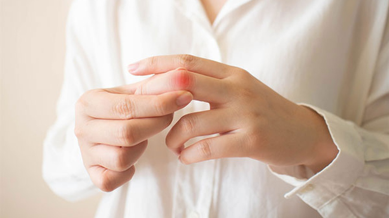 Thoái hóa khớp bàn tay, ngón tay: Triệu chứng và cách điều trị 3