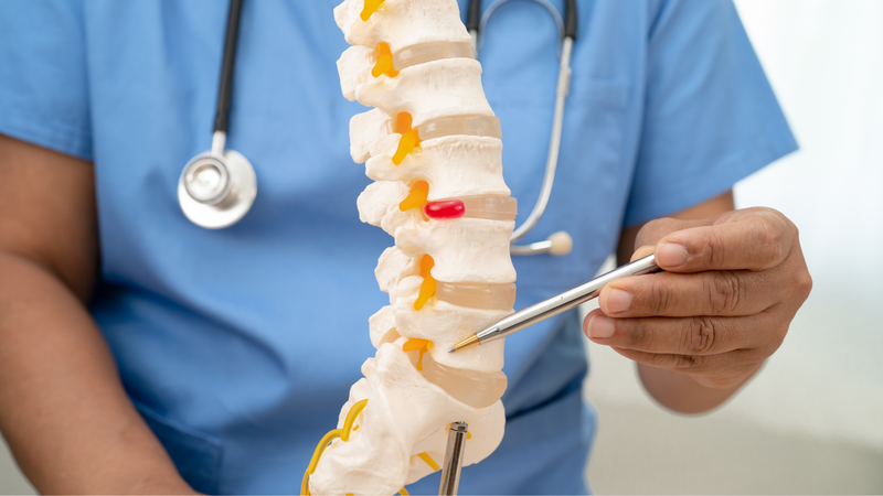 Thoát vị đĩa đệm cột sống cổ là gì?