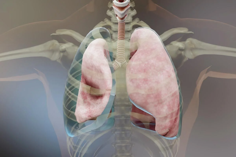 Thời gian điều trị tràn dịch màng phổi bao lâu? 4