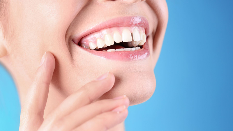 Thời gian hàn răng cửa thưa là bao lâu? Cần lưu ý những gì? 3