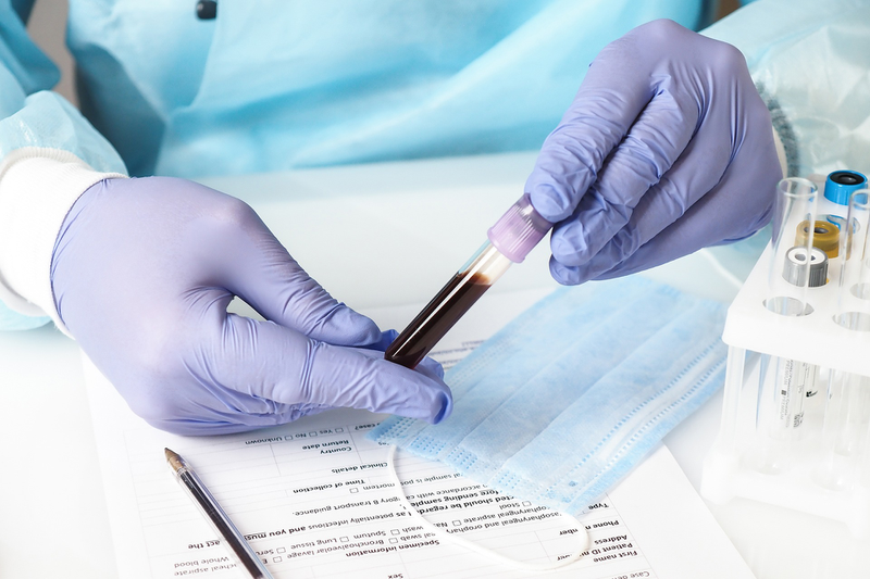 Những thông tin cần biết: Xét nghiệm máu tổng quát biết được những bệnh gì? 3