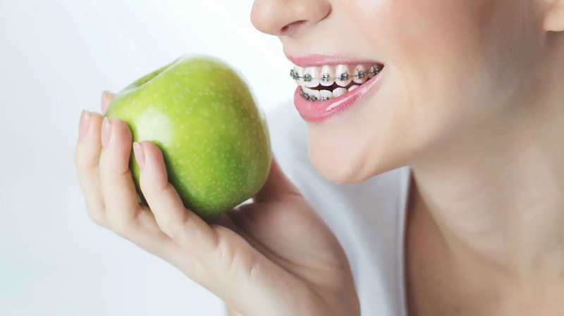 Thực đơn 7 ngày cho người niềng răng: Bí quyết ăn ngon, khỏe đẹp 3
