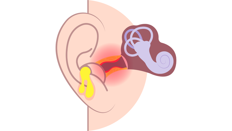 Thuốc kháng sinh điều trị viêm tai giữa và những điều bạn cần biết1
