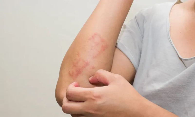 Thuốc mỡ kháng sinh bôi vết thương hở và những điều bạn cần biết 4