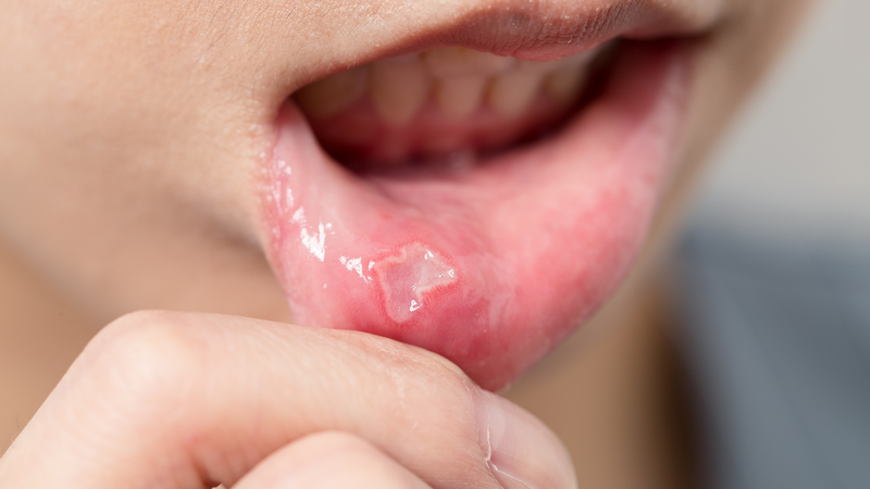 Tía tô kỵ với gì? Những lưu ý quan trọng khi ăn tía tô 4