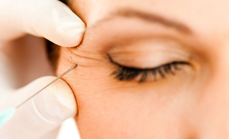 Tìm hiểu về tiêm botox xóa nhăn mắt​: Hiệu quả và nguy cơ tiềm ẩn 2