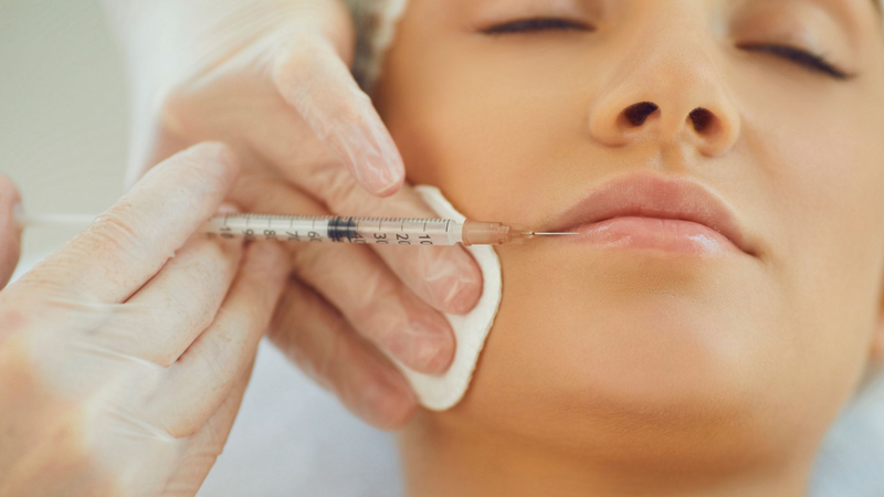 Tiêm filler bao lâu thì vào form? Lưu ý mà chị em cần biết trước khi lựa chọn tiêm filler 2