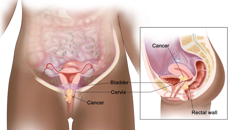 Tiêm HPV ở Hòa Bình tại đâu? Địa điểm, giá và cách đăng ký ra sao? 1