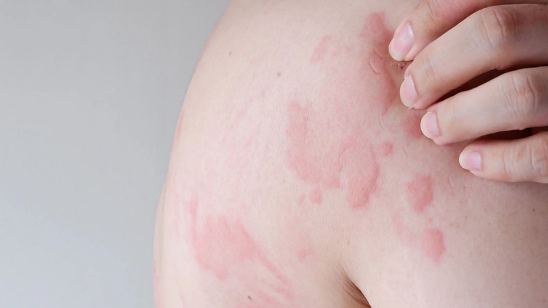 Tiêm vaccine dại không đủ phác đồ có tác dụng không? 3