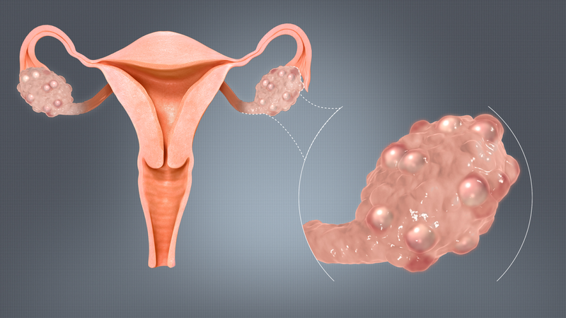 Tiểu đường thai kỳ ảnh hưởng như thế nào? Tác hại của tiểu đường thai kỳ đến mẹ và bé 2