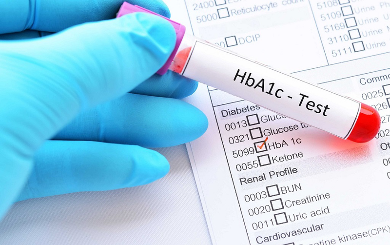 Tìm hiểu chỉ số HbA1c NGSP là gì? Tại sao cần phải kiểm soát chỉ số HbA1c? 1