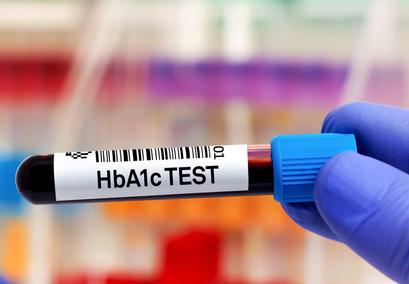 Tìm hiểu chỉ số HbA1c NGSP là gì? Tại sao cần phải kiểm soát chỉ số HbA1c? 3