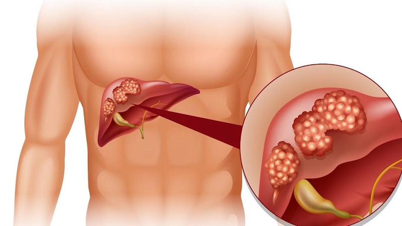 Tìm hiểu công dụng của rau đắng biển và rau đắng đất 3