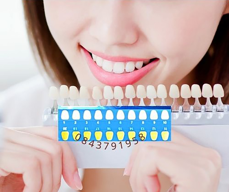 Tìm hiểu thang đo độ trắng của răng là gì? Cách so màu răng 2