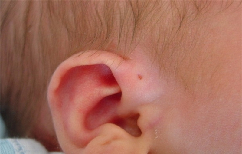 Tìm hiểu vành tai có tác dụng gì với cơ thể? 4