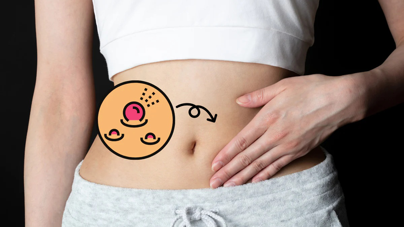 Tìm hiểu về điều trị nổi mụn ở bụng như thế nào? 1