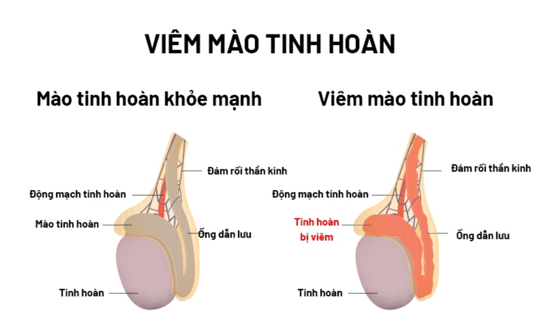 Tìm hiểu về giải phẫu tinh hoàn 4