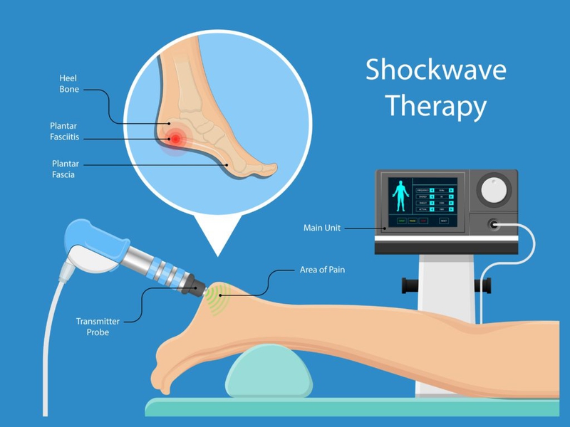 Tìm hiểu về sóng xung kích shockwave và ứng dụng trong y học 1
