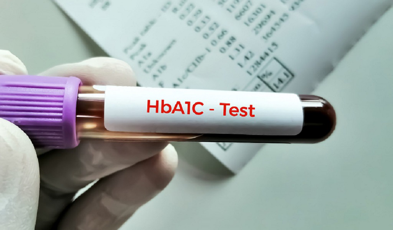 Tìm hiểu xét nghiệm HbA1c IFCC là gì? Những trường hợp cần xét nghiệm HbA1c IFCC 2