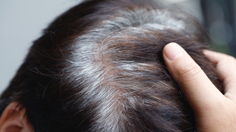 Tóc bạc ở trẻ em: Nguyên nhân, cách điều trị và những điều cha mẹ cần biết 1