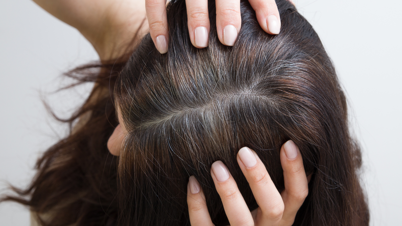 Tóc bạc ở trẻ em: Nguyên nhân, cách điều trị và những điều cha mẹ cần biết 2