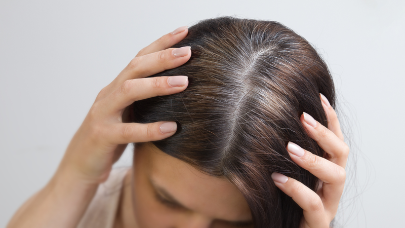 Tóc bạc ở trẻ em: Nguyên nhân, cách điều trị và những điều cha mẹ cần biết 3