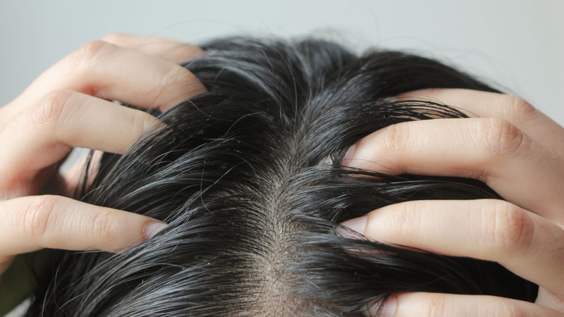 Tóc sâu là gì? Tại sao có tóc sâu ngứa, có nên nhổ không? 1