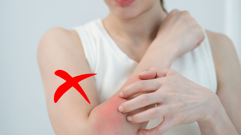Tránh gãi hoặc cào xước khi nổi mẩn ngứa
