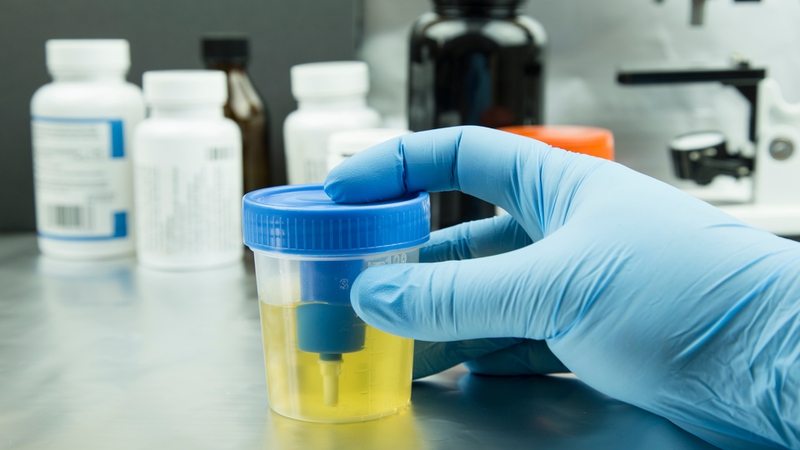 Thời gian trả kết quả xét nghiệm tổng phân tích nước tiểu thường khá nhanh