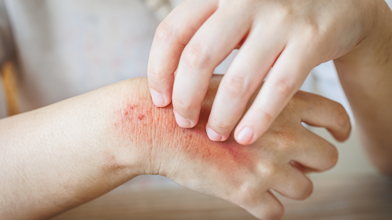 Tổng quan về quả thanh long - Những lợi ích của thanh long đối với sức khỏe 4