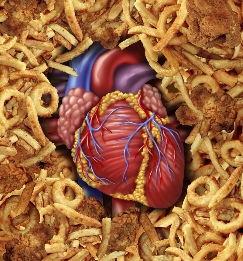 Khi cơ thể tiêu thụ lượng lớn chất béo trans sẽ có nguy cơ mắc các bệnh tim mạch tăng lên đáng kể