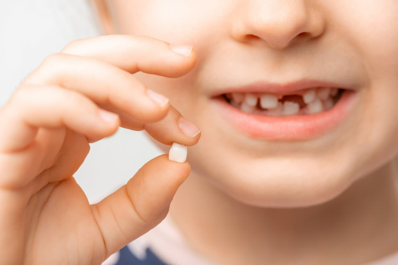 Trẻ bị gãy răng sữa có mọc lại không? Phải làm sao khi trẻ gãy răng?1