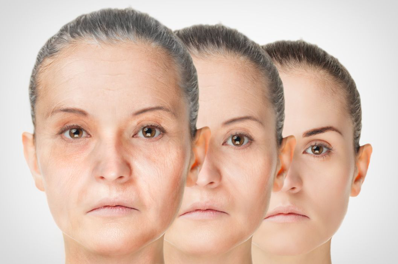Trẻ hóa da mặt là gì? Các phương pháp trẻ hóa da mặt phổ biến 4