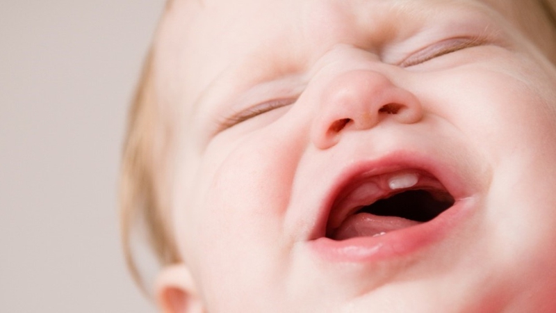 Trẻ mọc răng không đúng thứ tự có ảnh hưởng gì không 2