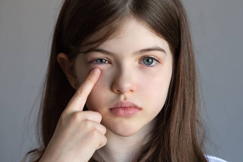 Trẻ nháy mắt liên tục: Nguyên nhân và cách chữa trị 2