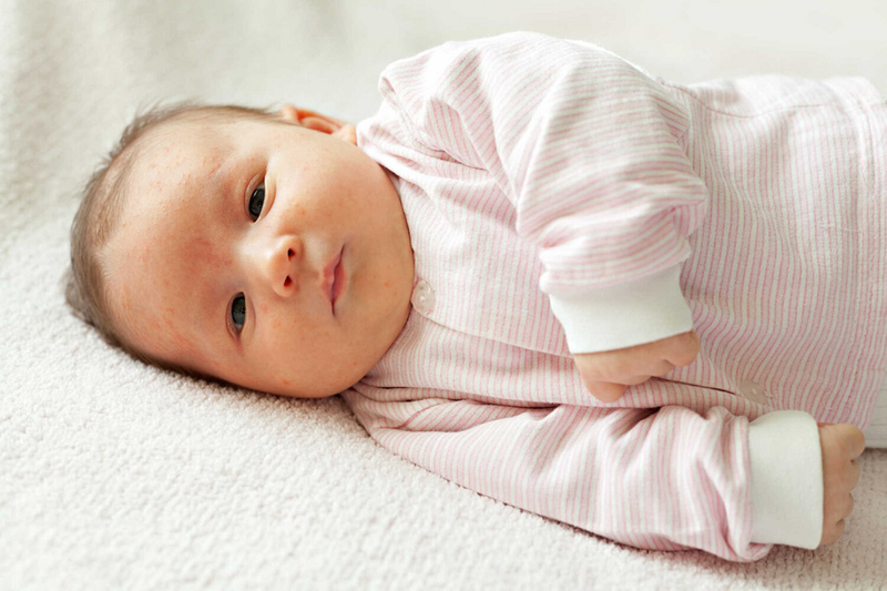 Trẻ sơ sinh bị nóng trong mẹ nên ăn gì? Lời khuyên của chuyên gia dinh dưỡng dành cho mẹ 1